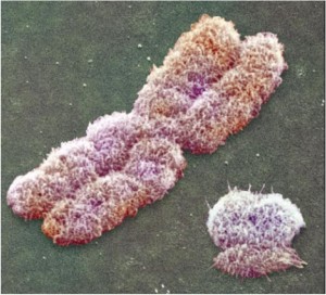 X-cromosome